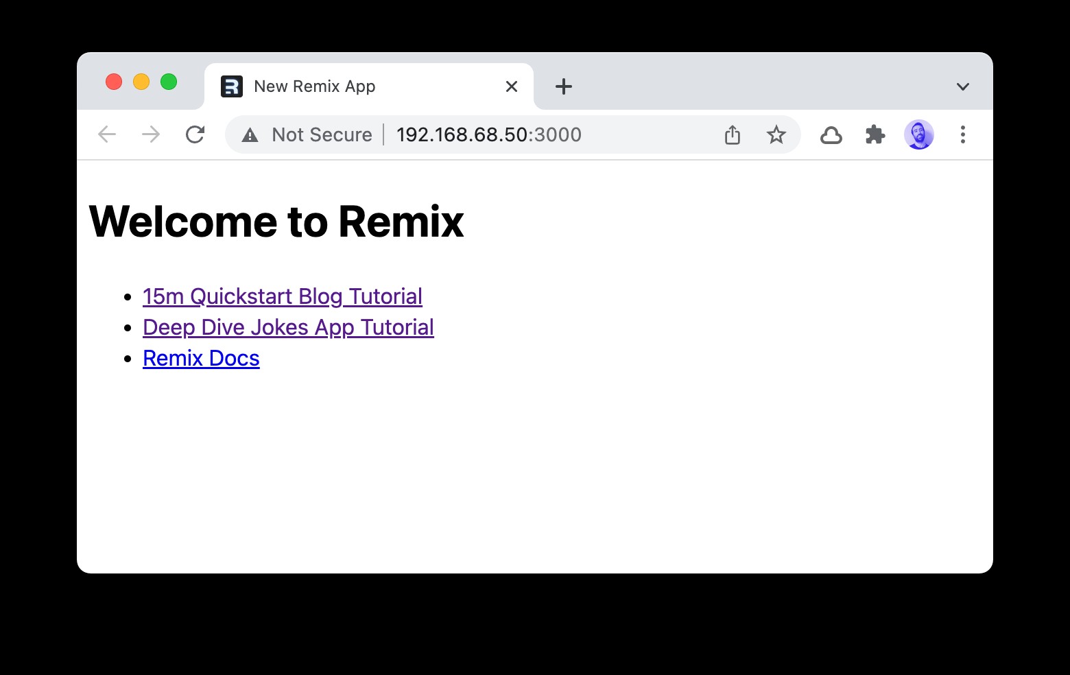 Remix와 서버리스 Redis(Upstash)로 TODO 앱 만들기