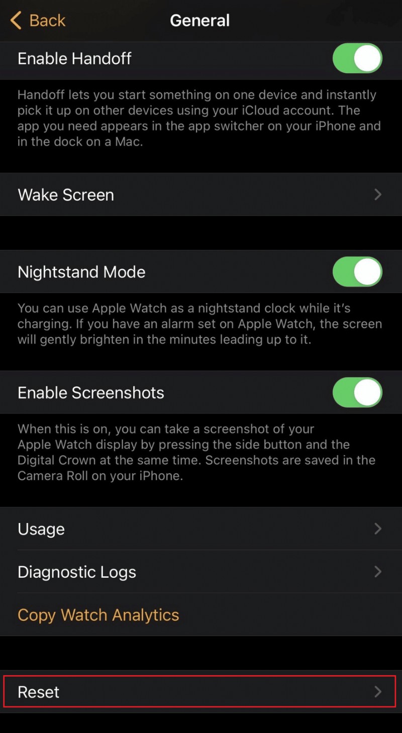 Apple Watch에서 Apple ID 제거하는 방법 완벽 가이드