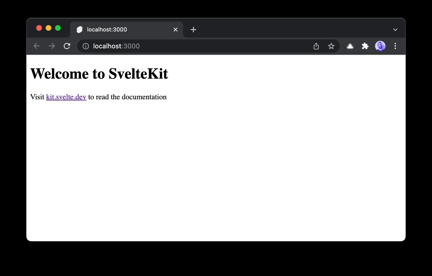 Redis가 포함된 SvelteKit TODO 앱 