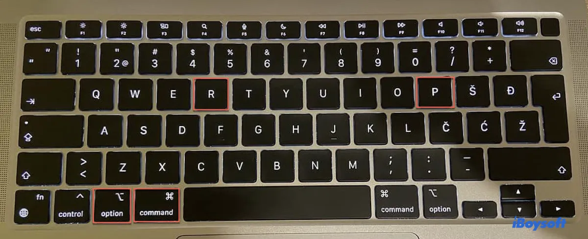 MacBook 화면이 계속 실행되는 동안 검은색으로 변합니다:원인 및 해결 방법 