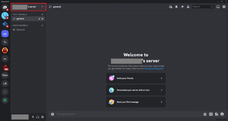 Discord 감사 로그 제거:단계별 가이드 